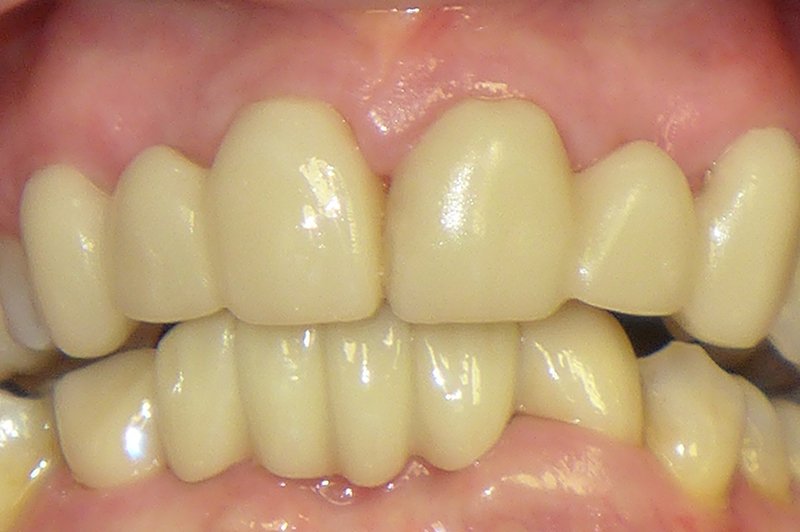 Smile Gallery - After