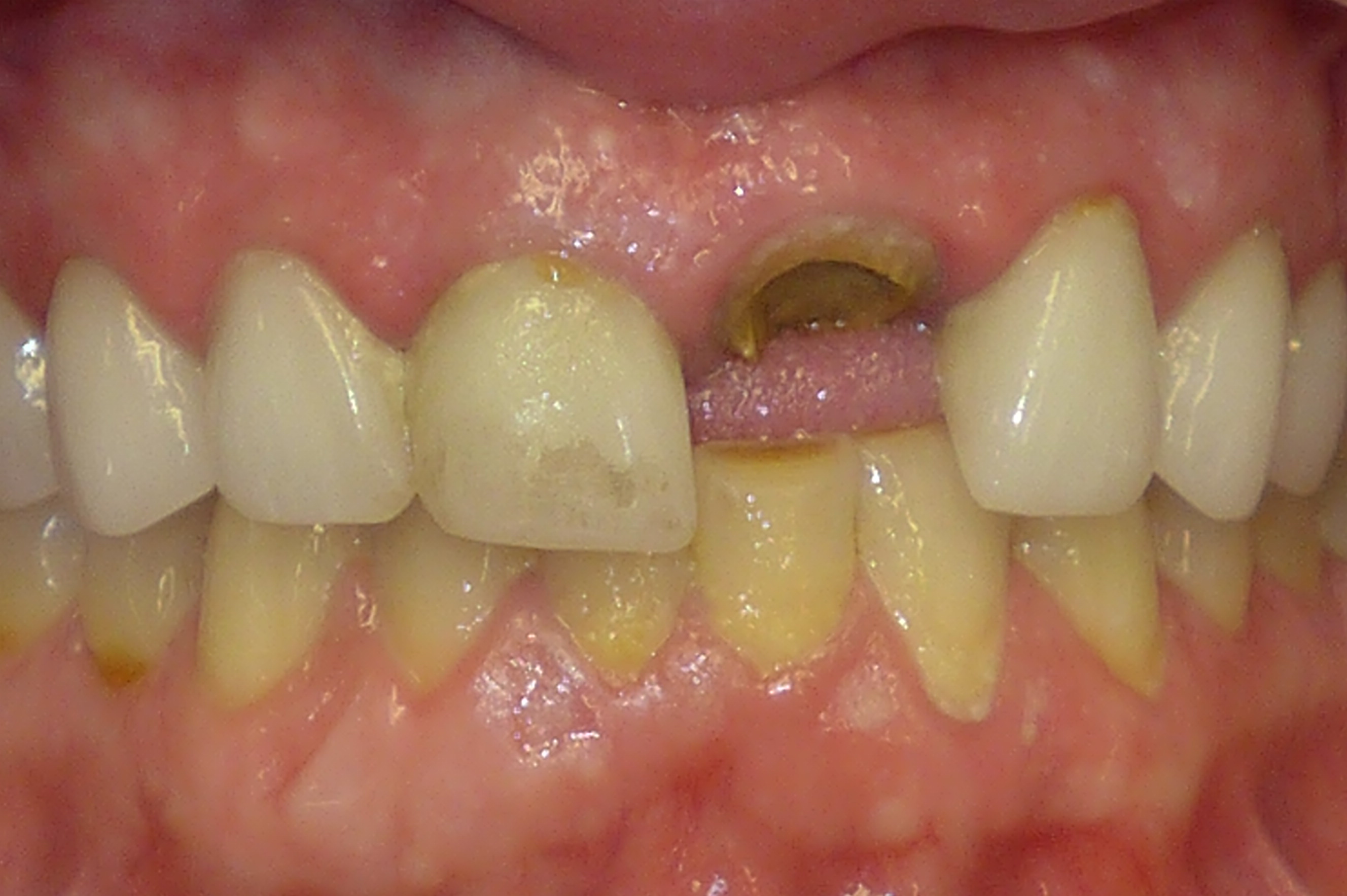 Smile Gallery - Before