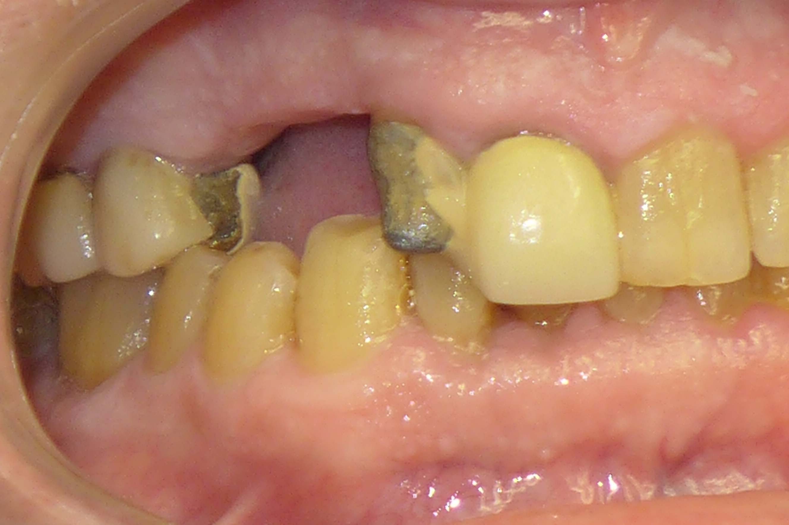 Smile Gallery - Before